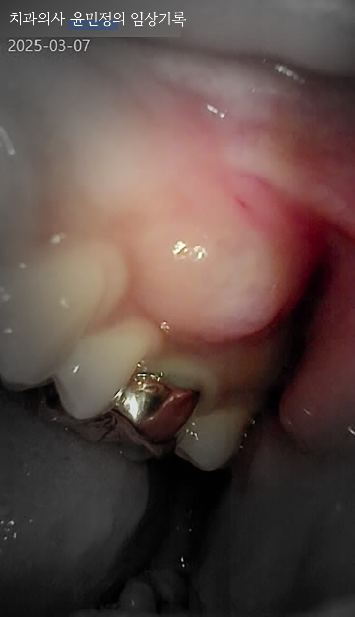 Treatment case image 1