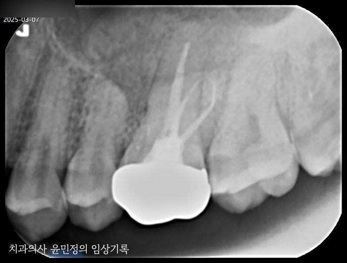 Treatment case image 2