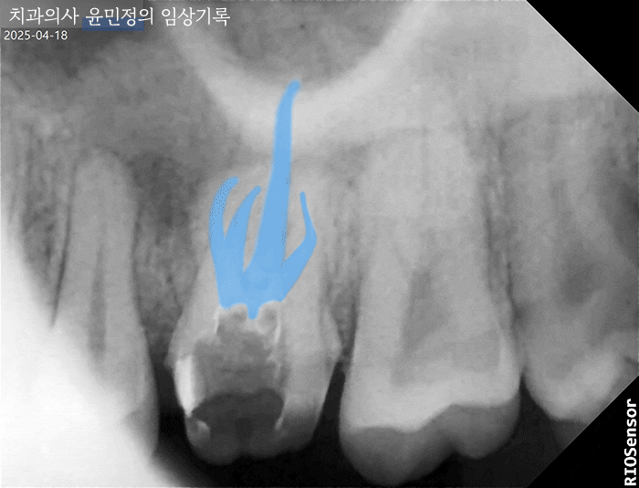 Treatment case image 3