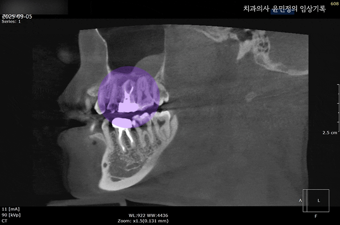 Treatment case image 4