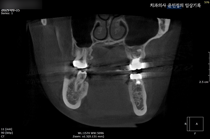 Treatment case image 9