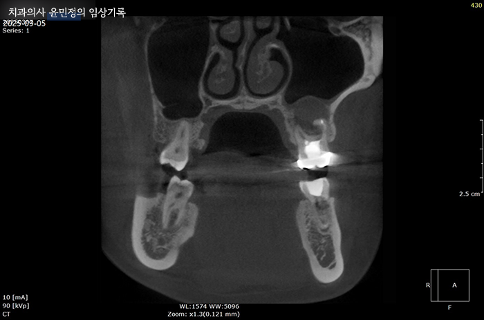Treatment case image 10