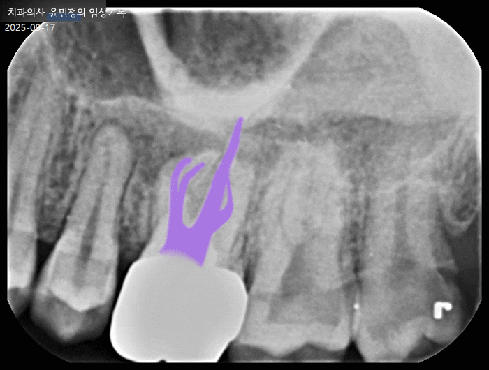 Treatment case image 11