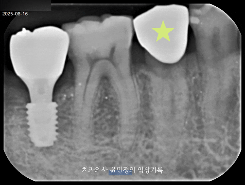 Treatment case image 1