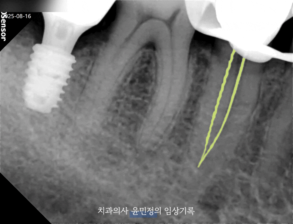 Treatment case image 4