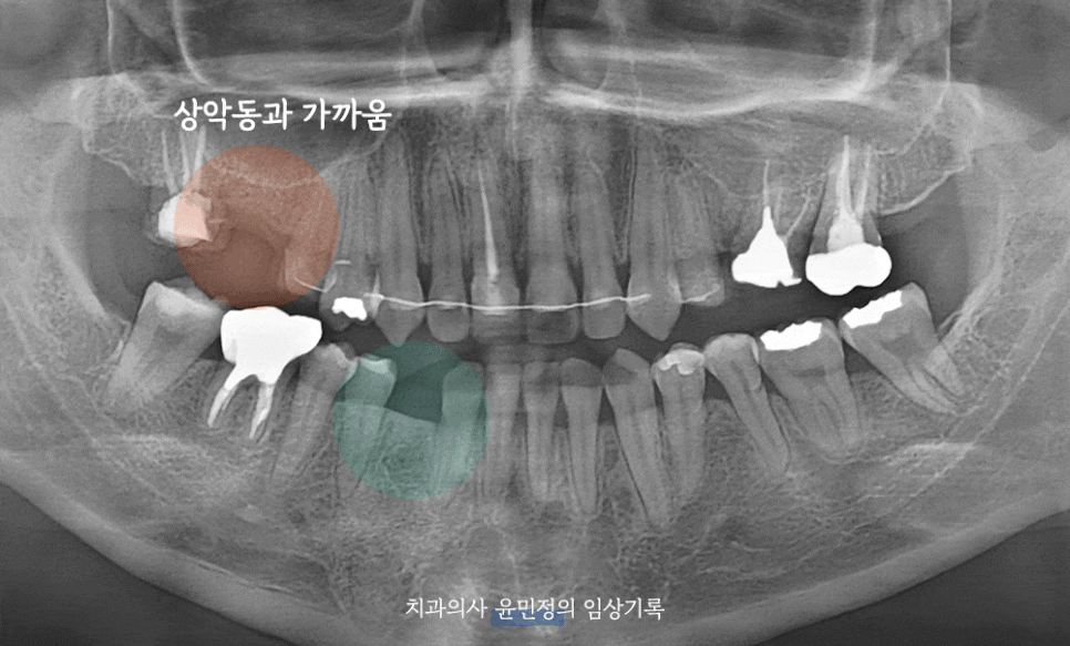 Treatment case image 1