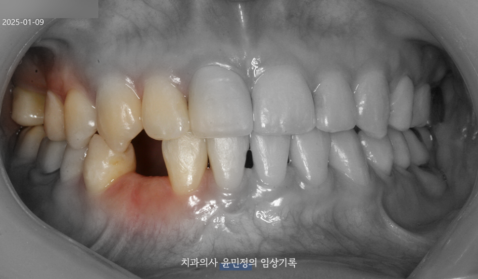 Treatment case image 2