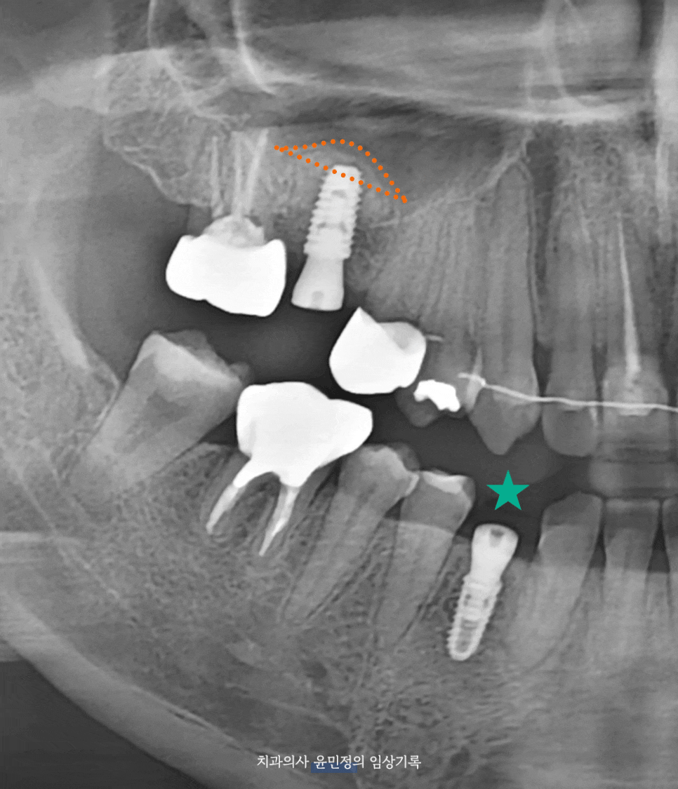 Treatment case image 5