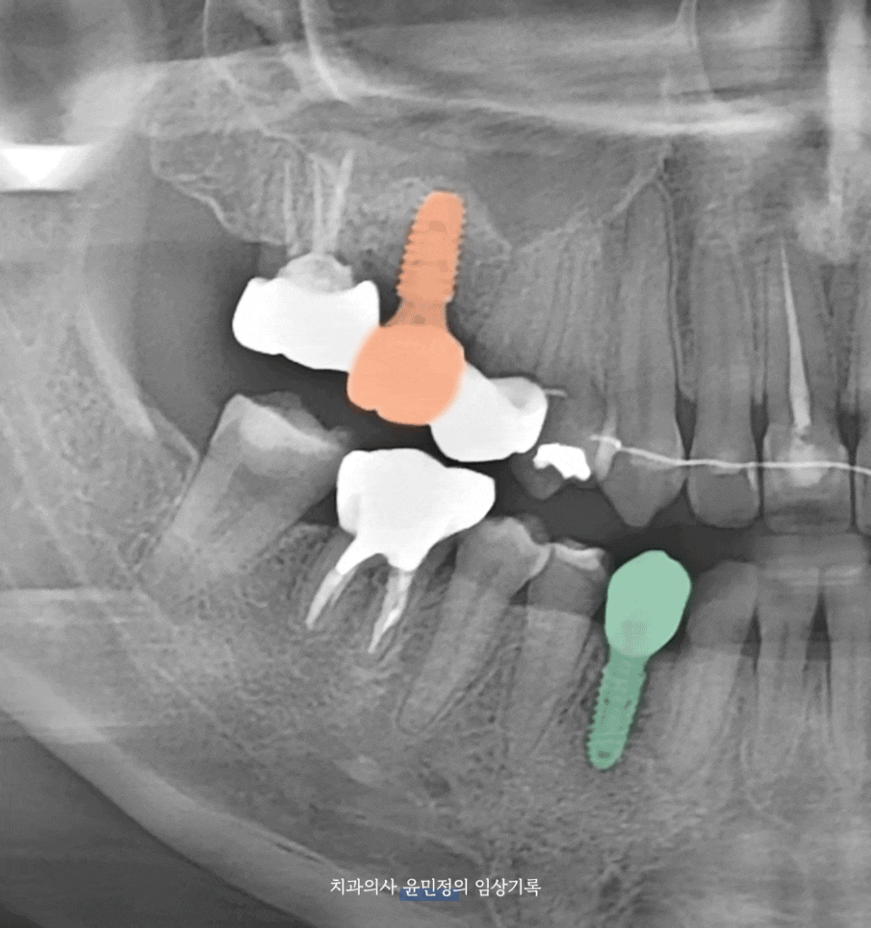 Treatment case image 7
