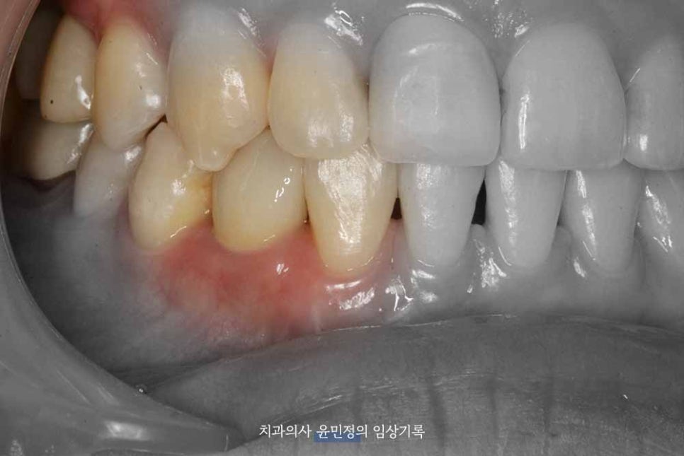 Treatment case image 8