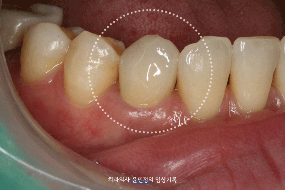 Treatment case image 9