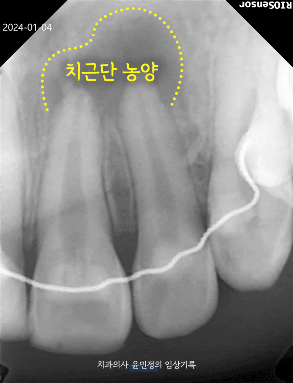 Treatment case image 2