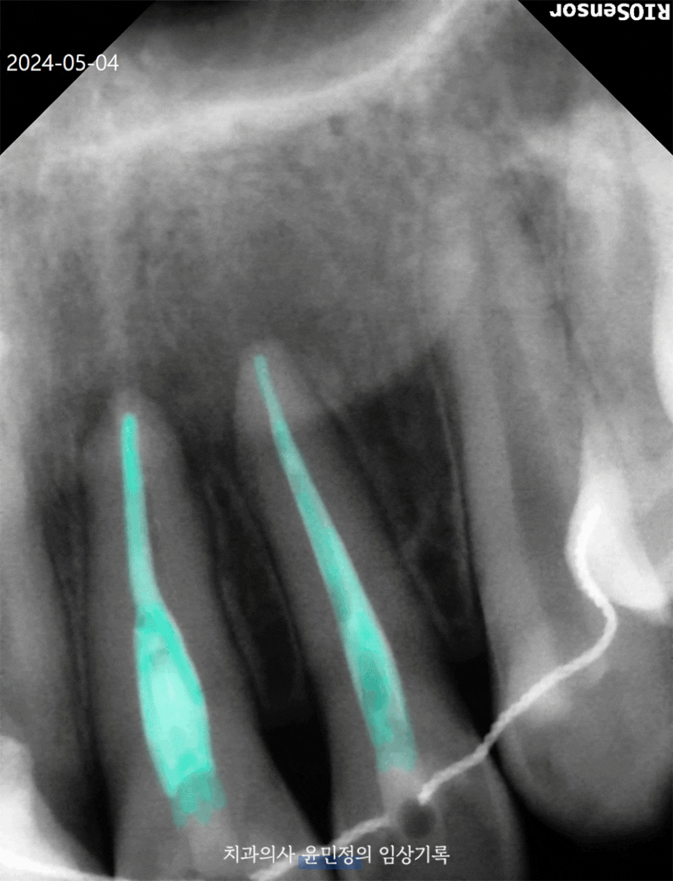 Treatment case image 4