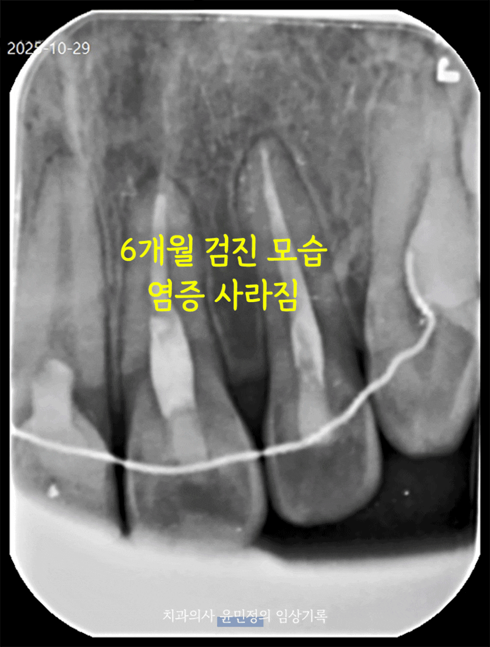 Treatment case image 6