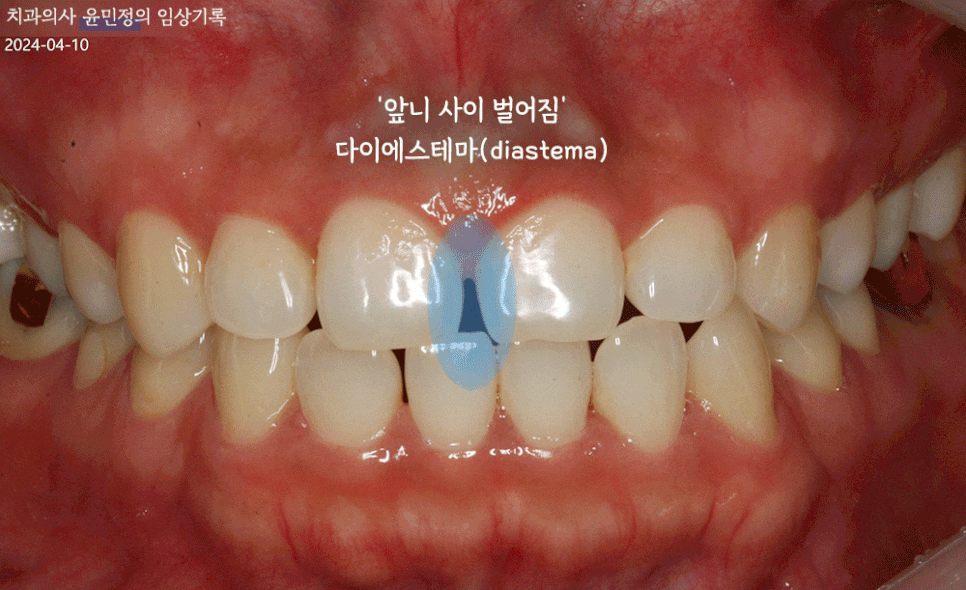 Treatment case image 1