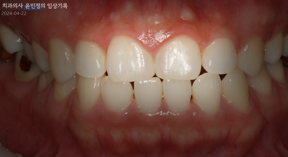 Treatment case image 2