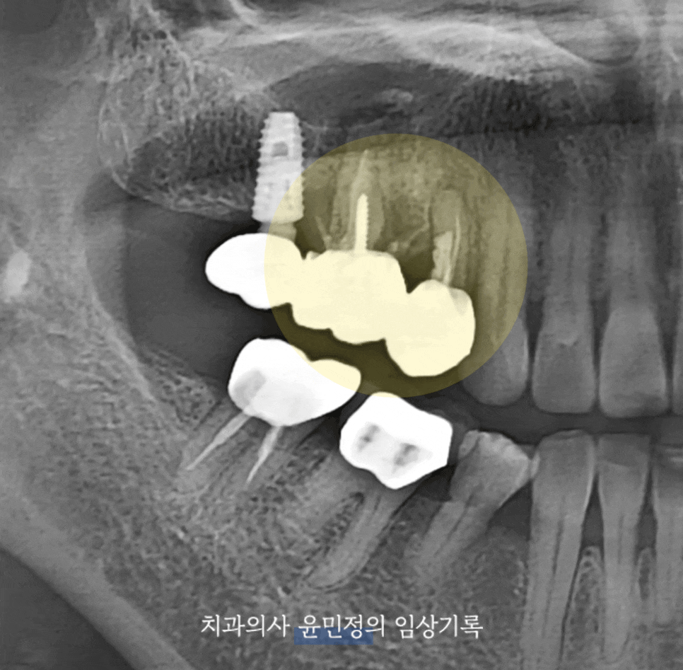 Treatment case image 1