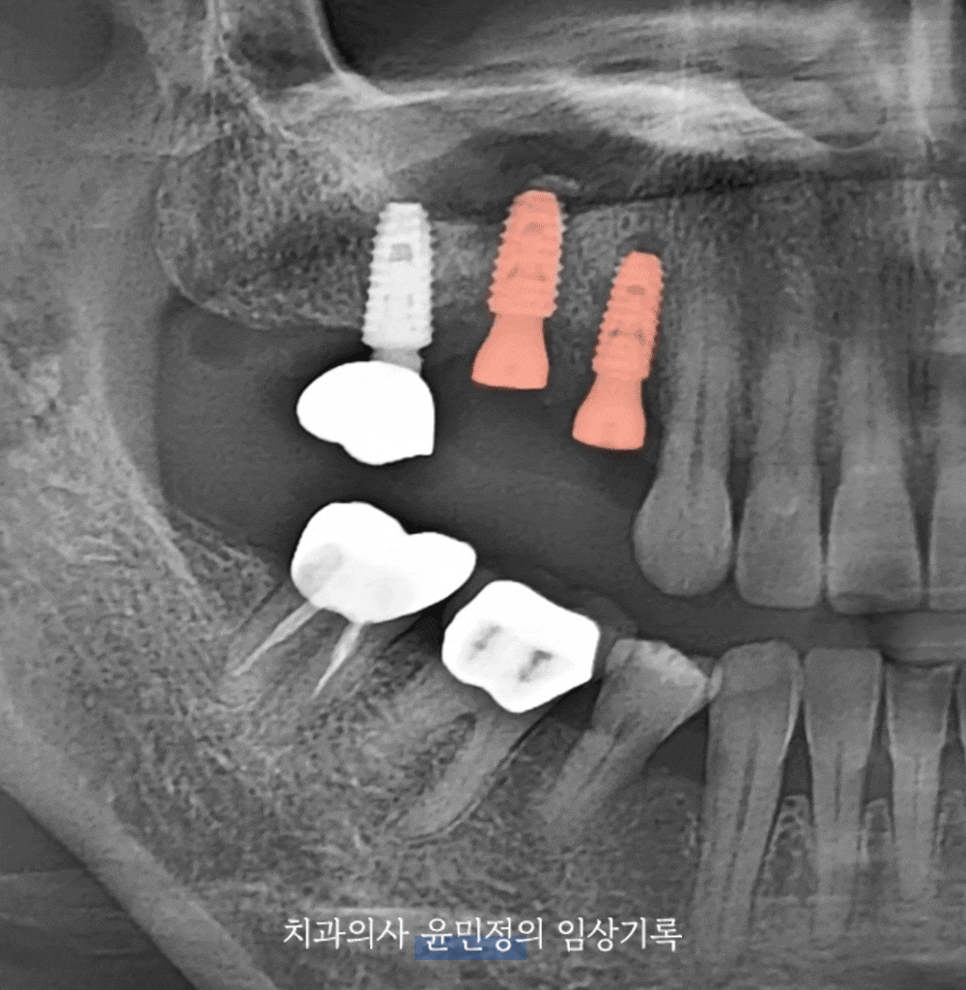 Treatment case image 2