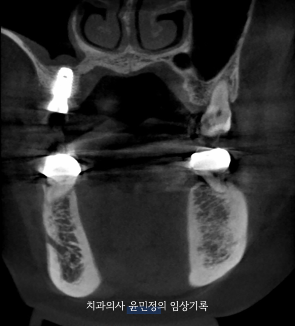 Treatment case image 4