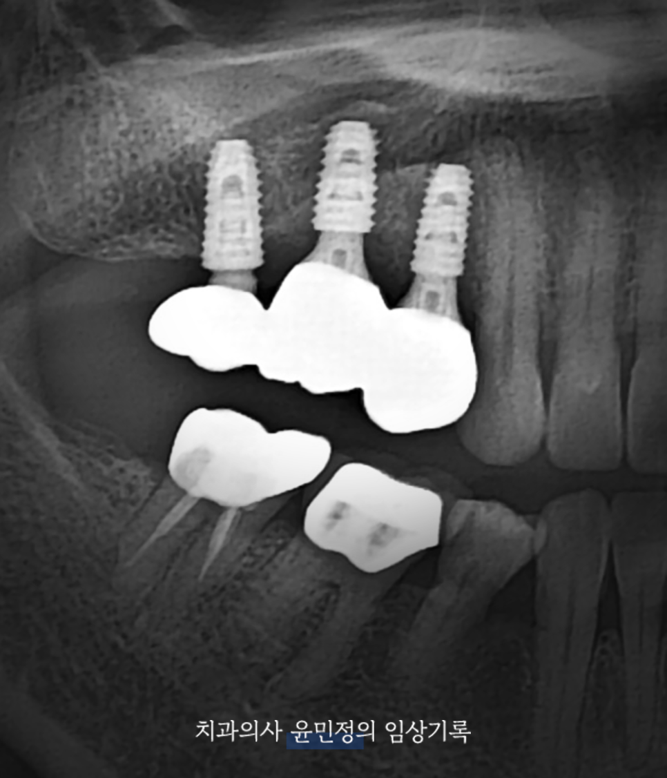 Treatment case image 5