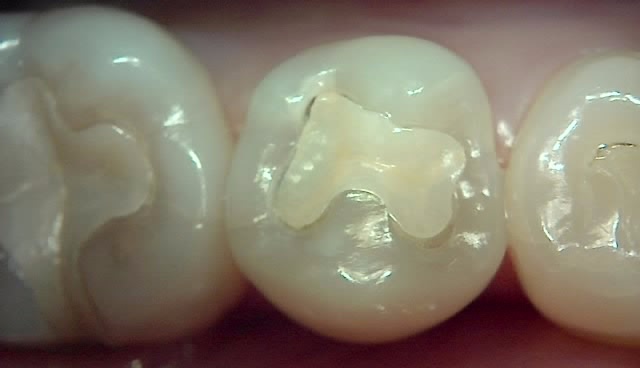 Treatment case image 1