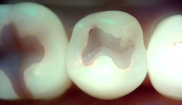 Treatment case image 3