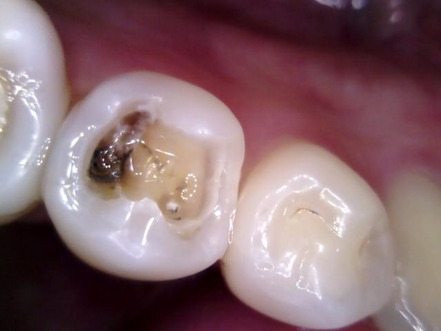 Treatment case image 4