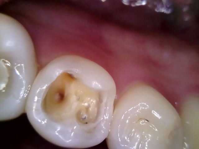 Treatment case image 5