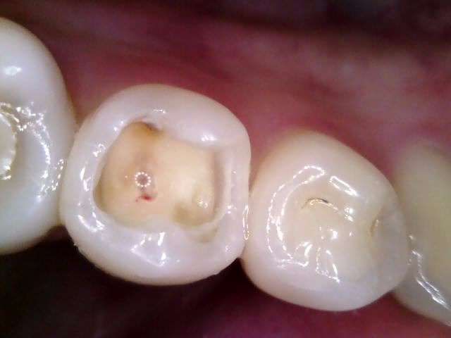 Treatment case image 6
