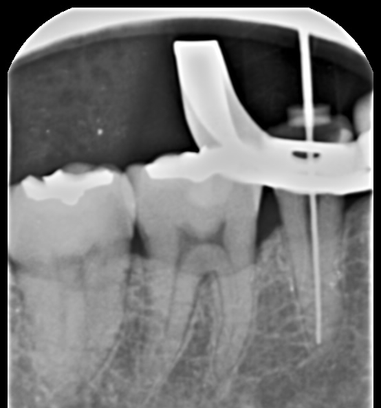 Treatment case image 7
