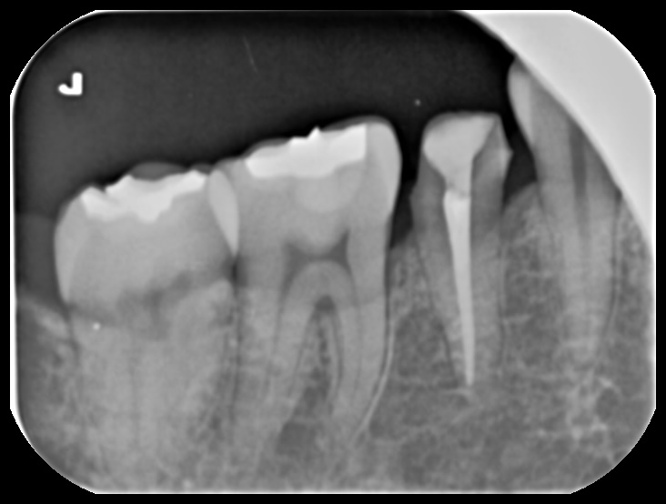 Treatment case image 8