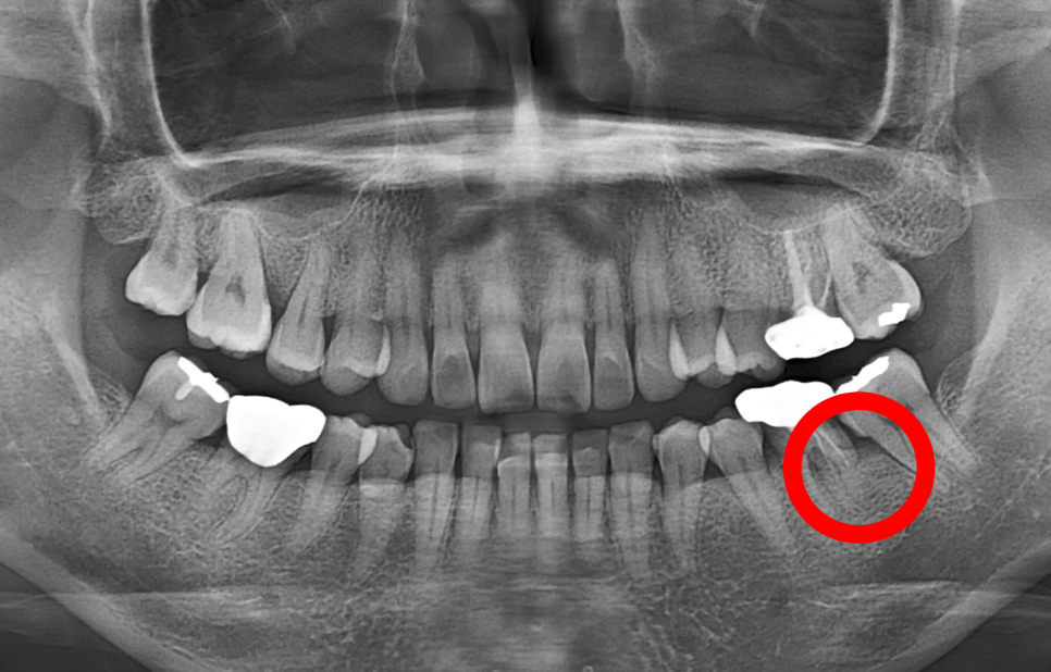 Treatment case image 1