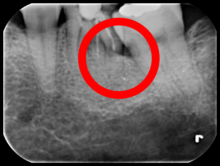 Treatment case image 2