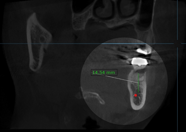 Treatment case image 5