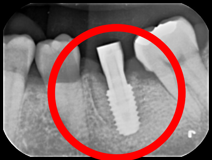 Treatment case image 6