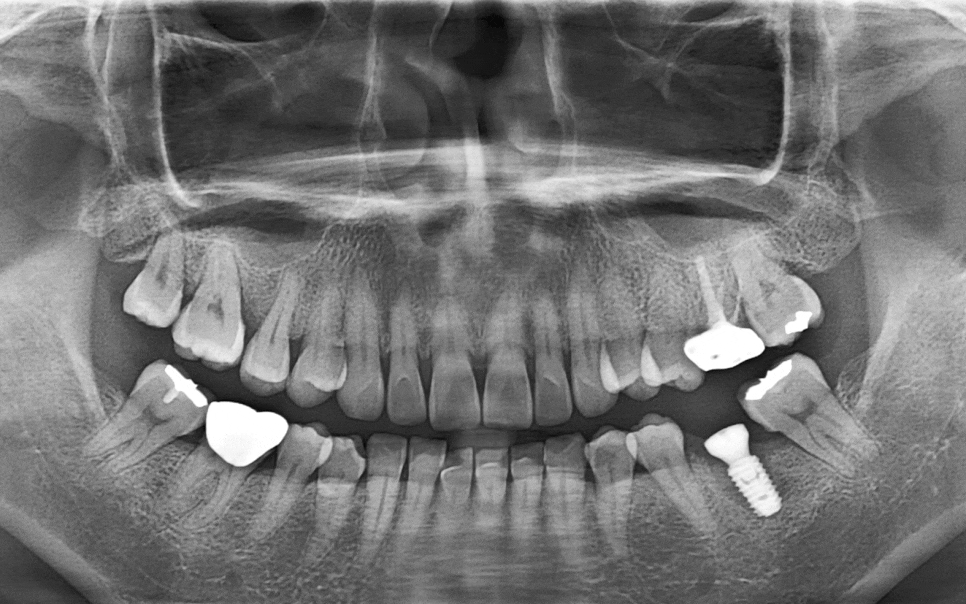 Treatment case image 9