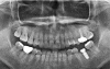 Treatment case image 5