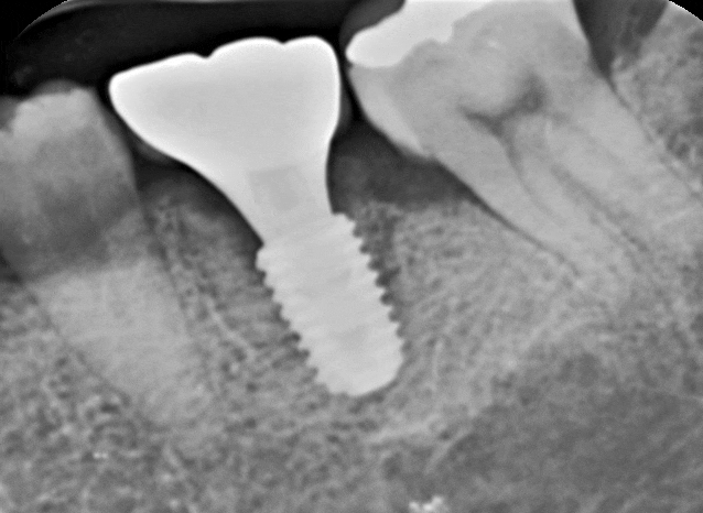 Treatment case image 10