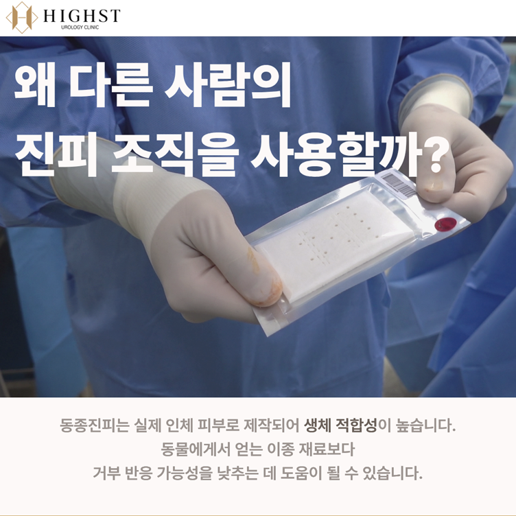동종진피 안내 이미지 2