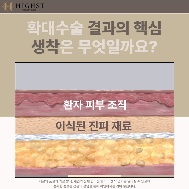 동종진피 안내 이미지 4