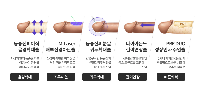 치료스토리 - 남성의 자신감을 찾아주는 통합 솔루션 강남비뇨기과 5S 복합수술 