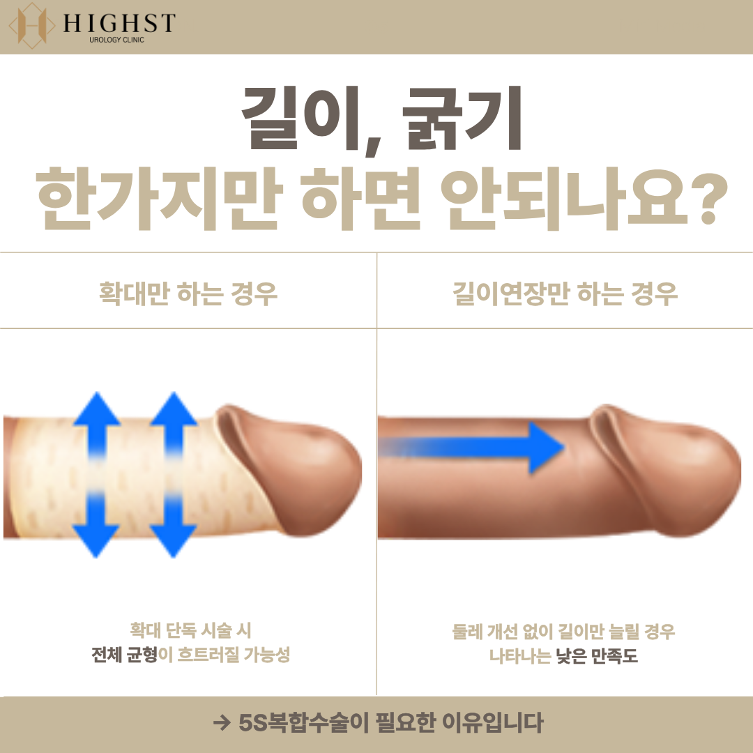 5S복합수술 안내 이미지 2